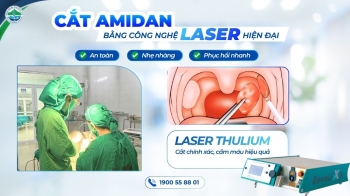 Cắt Amidan công nghệ Laser – ít đau, ít chảy máu, phục hồi nhanh