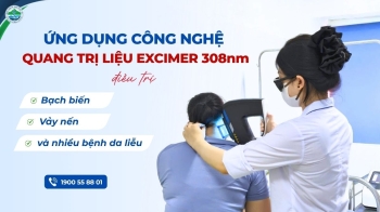 Điều trị bạch biến, vảy nến bằng công nghệ ánh sáng Excimer 308nm