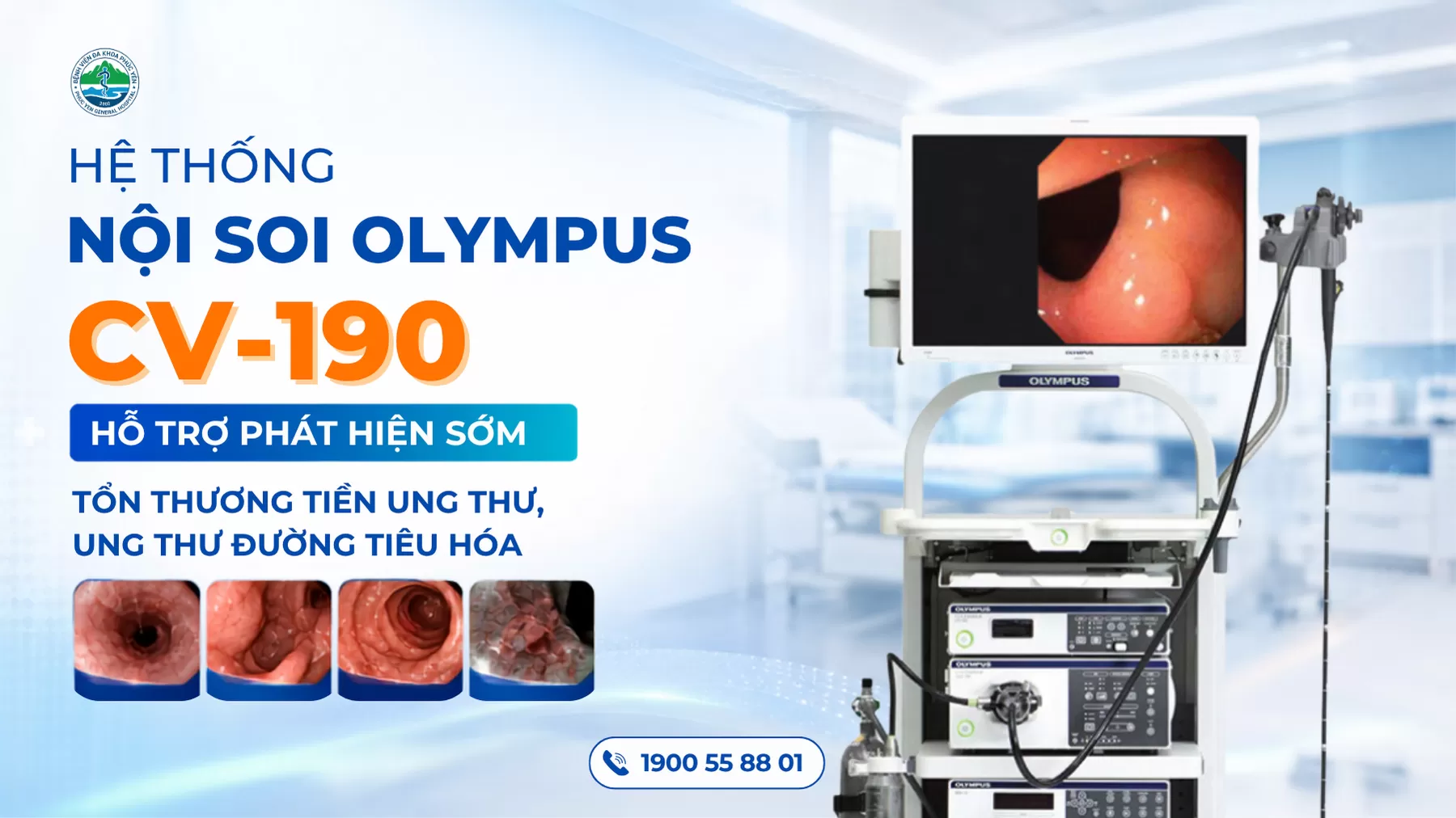 Hệ thống Nội soi Olympus CV-190: Hỗ trợ phát hiện sớm tổn thương tiền ung thư, ung thư đường tiêu hóa