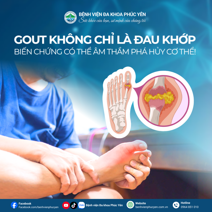 Gút không chỉ là đau khớp – Biến chứng có thể âm thầm phá hủy cơ thể!