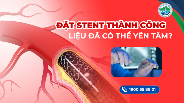 Đặt STENT thành công - Liệu đã có thể yên tâm?