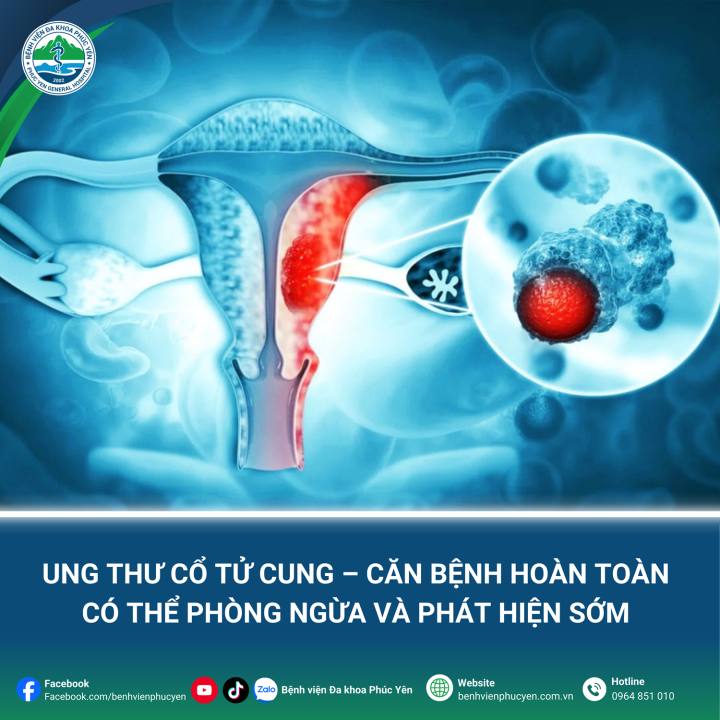 Ung thư cổ tử cung – Căn bệnh hoàn toàn có thể phòng ngừa và phát hiện sớm